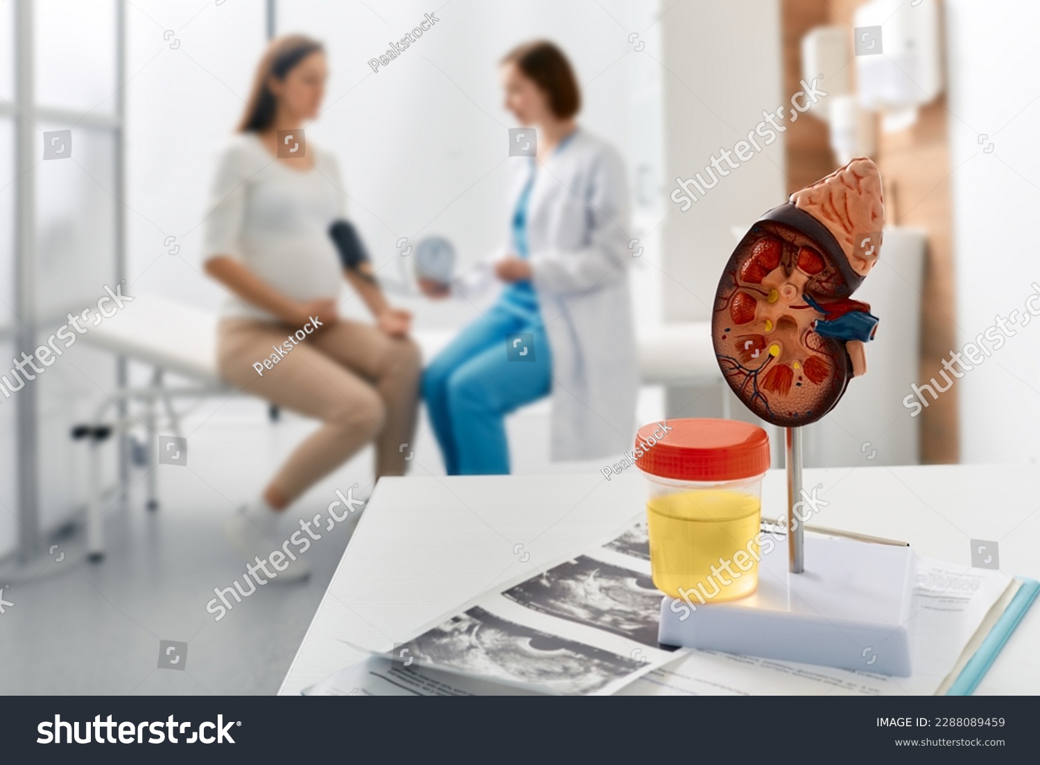 Treatment of pyelonephritis and kidney disease in pregnant women. Urologist consultation for pregnant woman with kidney pain and inflammation while visit to medical clinic